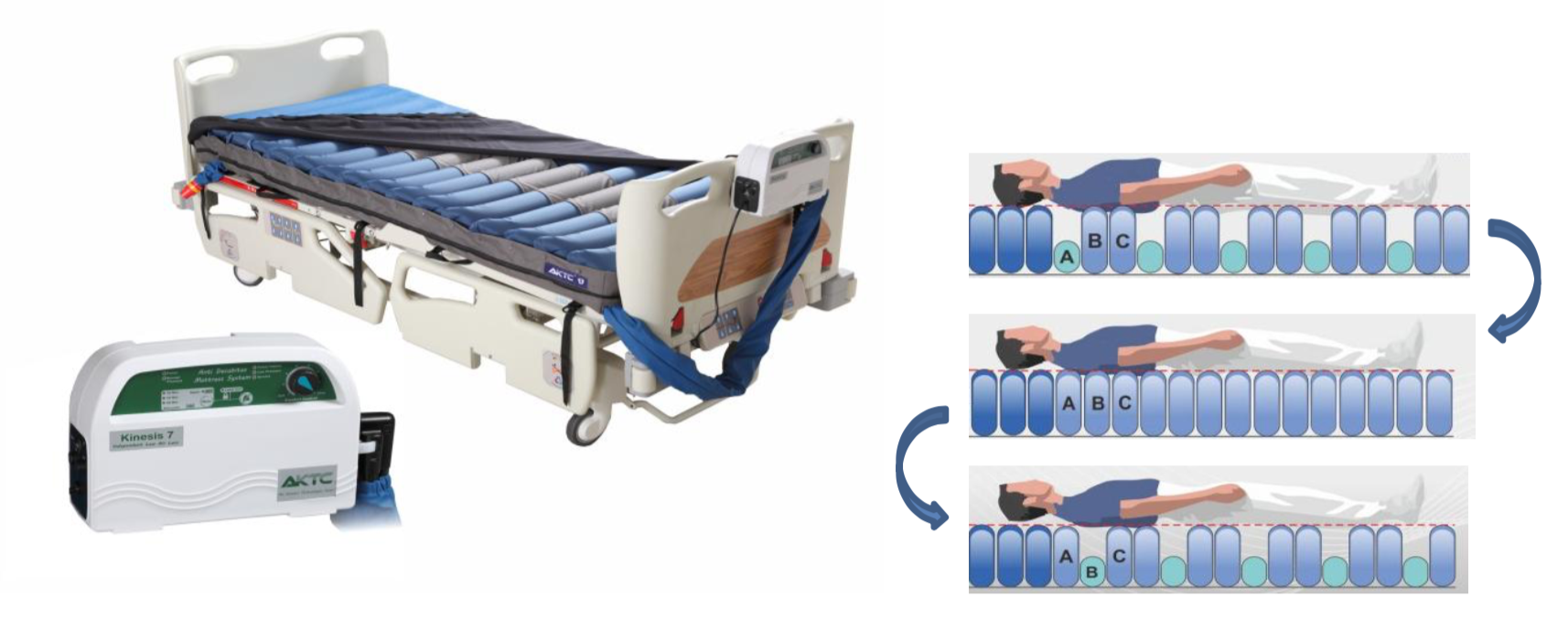 benefits of alternating air mattress